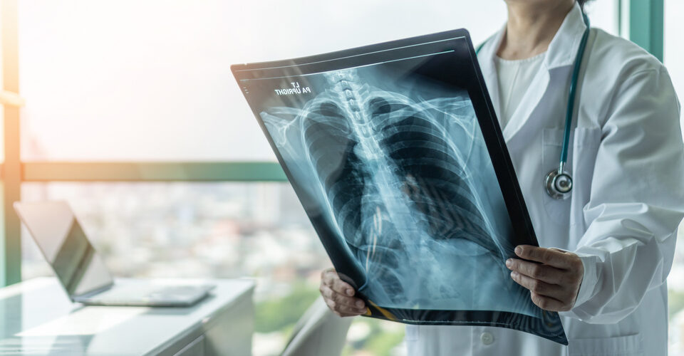 When to See a Pulmonary Specialist: Understanding Common Lung Conditions and Symptoms