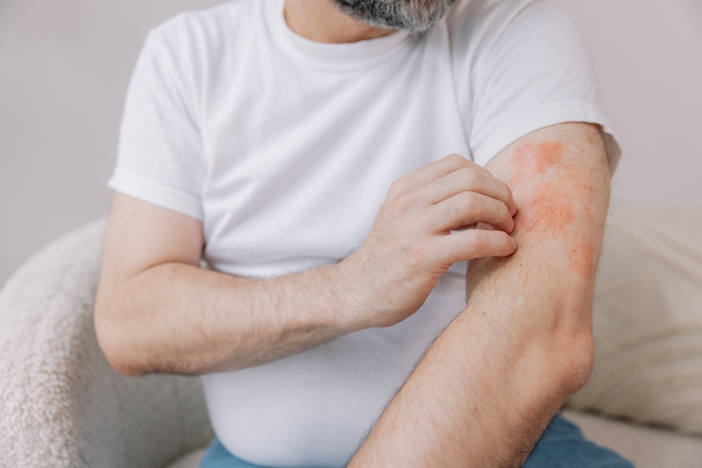 Psoriasis and Eczema: Understanding Chronic Skin Conditions and Treatment Options